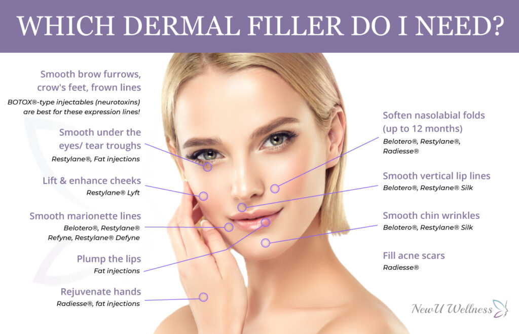 which dermal filler do you need?