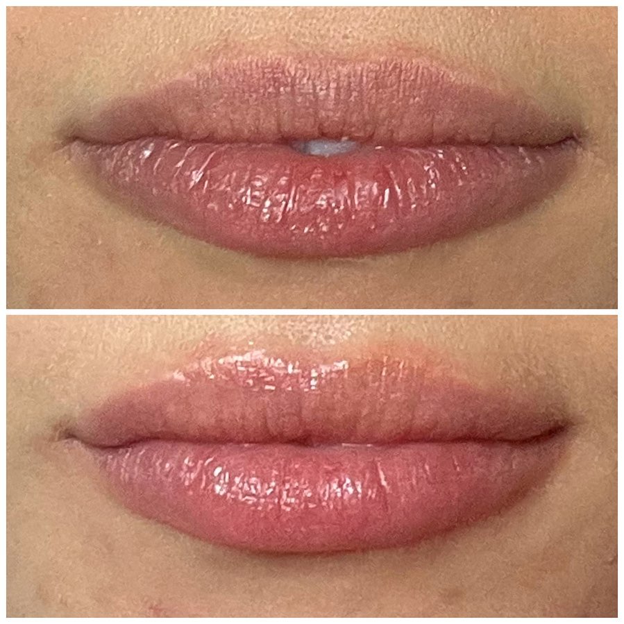 Effect of Lip Replenishing Serum