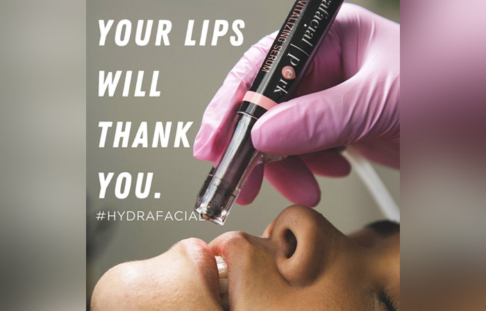 Read more about the article Discover the Perk Lip Treatment with NewU Wellness’s Lip Replenishing Serum by Hydrafacial