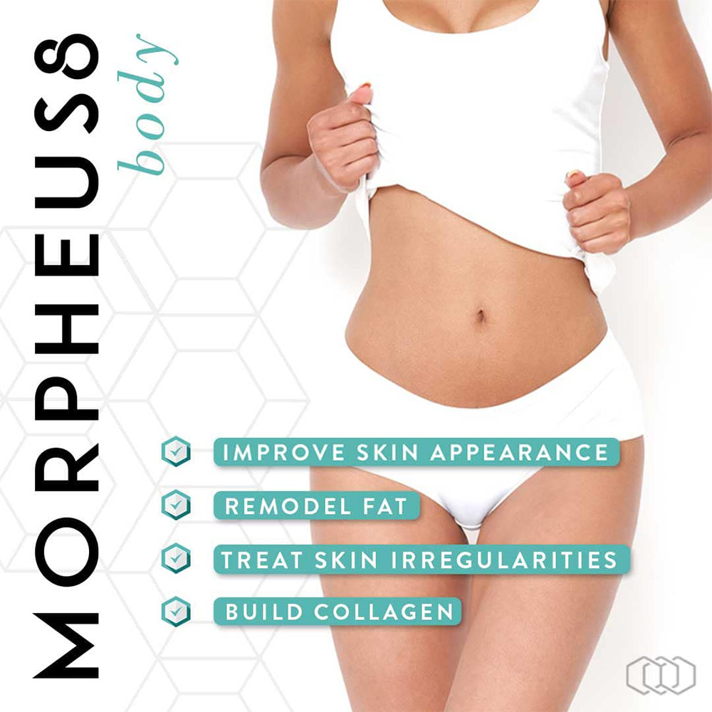 Morpheus8 body model with benefits